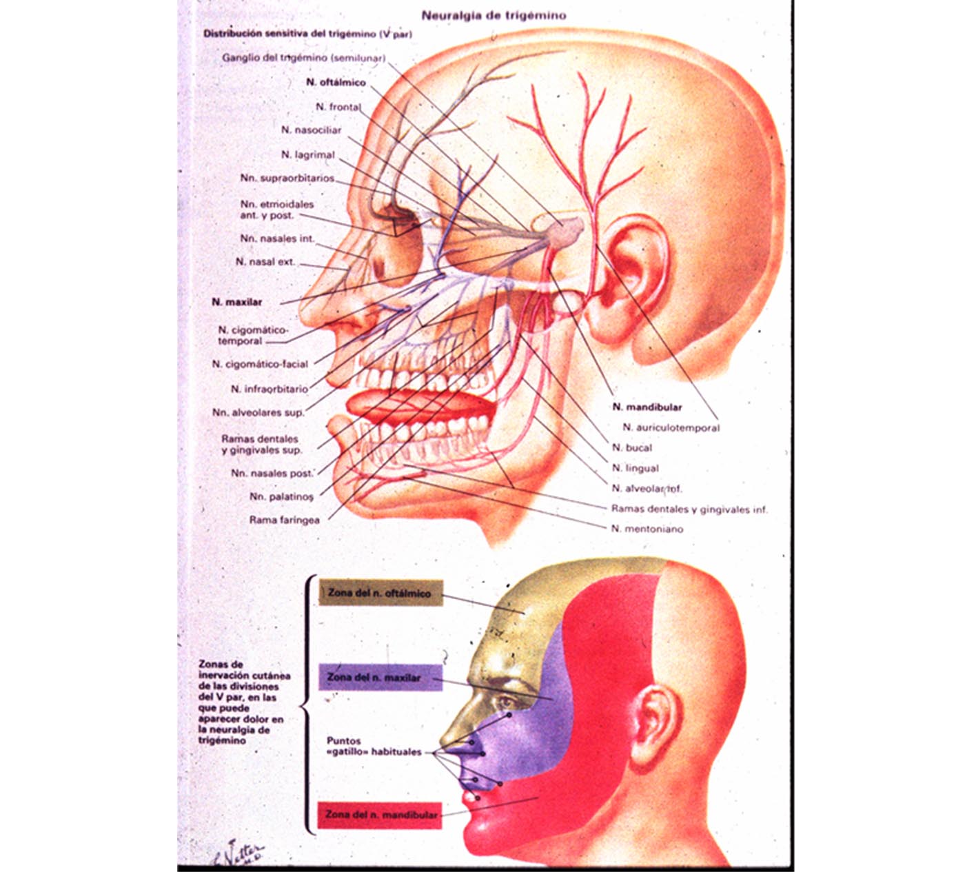 Neuralgia del trigémino, la enfermedad más dolorosa